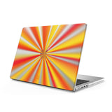 Dazzling Light - Clear MacBook Case