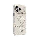 Sweet Kiss - iPhone Case