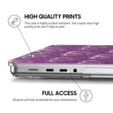 Loyalty - Clear MacBook Case (Glitter)