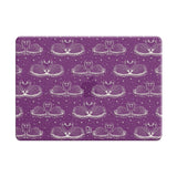 Loyalty - Clear MacBook Case (Glitter)