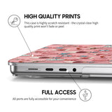 Party - Clear MacBook Case (Glitter)