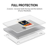 Anxiety - Clear MacBook Case