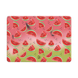 icy Cool - Clear MacBook Case