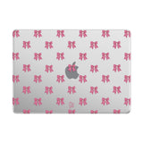 Surprise - Clear MacBook Case